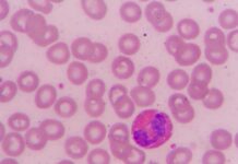 Riddoch, Lady Nelson to light up